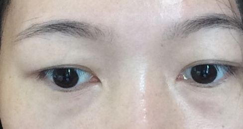 杭州祛雀斑哪家醫(yī)院好？選擇最適合您需求的專業(yè)祛雀斑醫(yī)院