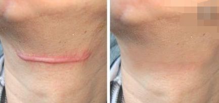 貴州哪個醫(yī)院做眼袋手術(shù)好