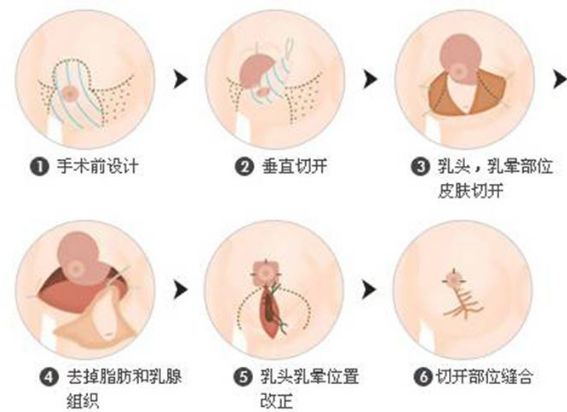 保定的整形醫(yī)院哪家好？全面解析保定整形醫(yī)院排名、口碑、專業(yè)團隊等