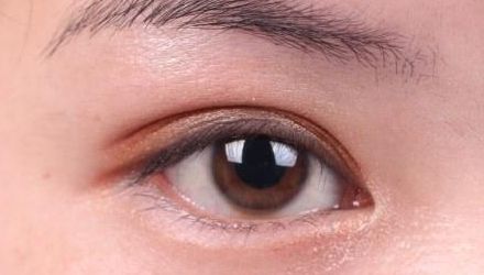 蘇州雙眼皮修復醫(yī)院排名及口碑，哪家醫(yī)院修復效果最好？