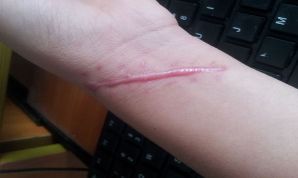 上海鼻子整形哪家醫(yī)生好？整形手術中哪位醫(yī)生在上海受歡迎？