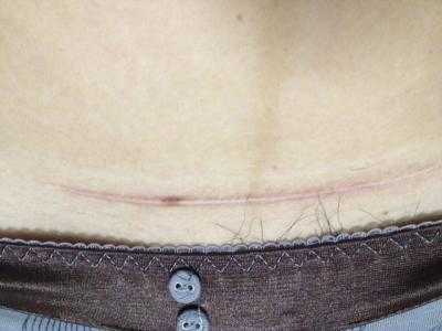 2023蘭州自體填充面部醫(yī)生前10位強榜(張志慶、徐隴豫、葉海云價格高低對比)