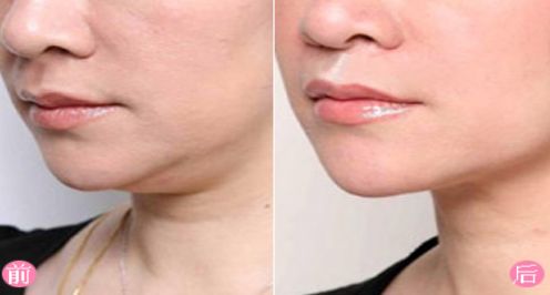 上海去除胎記醫(yī)院排名及口碑評測，哪家醫(yī)院最受用戶好評？