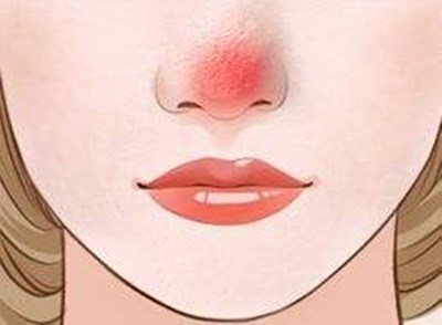 廣州最新開設(shè)的軍事美容整形醫(yī)院，王世虎是權(quán)威整形專家，手術(shù)價(jià)便宜