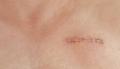 南昌市整形醫(yī)院哪家好？完全解析南昌市整形醫(yī)院的專業(yè)技術(shù)和服務(wù)