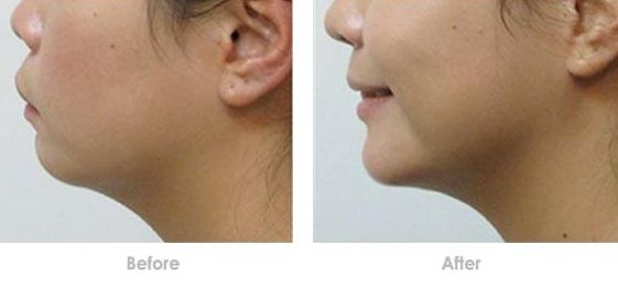 成都哪家醫(yī)美醫(yī)院做皮秒好？了解成都皮秒治療哪家醫(yī)院口碑好