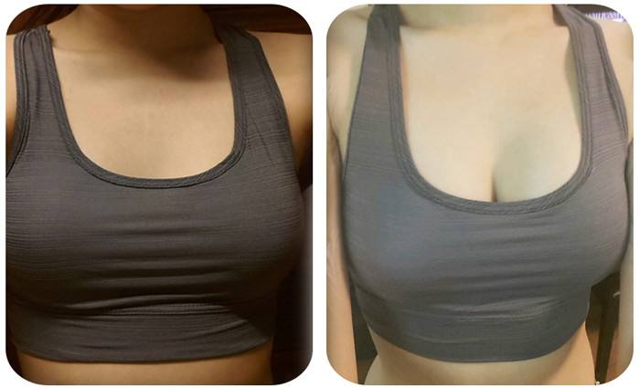 2023周口上眼瞼玻尿酸填充大型醫(yī)生口碑排名(宋明義、湯芳芳、趙北永公立私立都有)