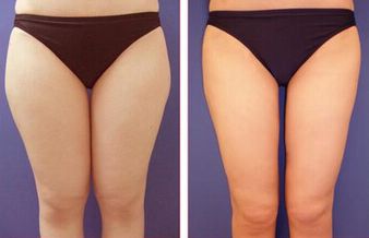 廣州看痘印哪家醫(yī)院好？細(xì)數(shù)廣州治療痘印最佳醫(yī)院！