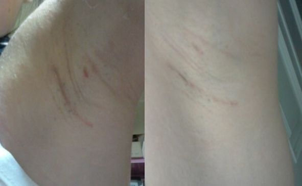 恩施地區(qū)有哪些信譽(yù)好的美容整形醫(yī)院？