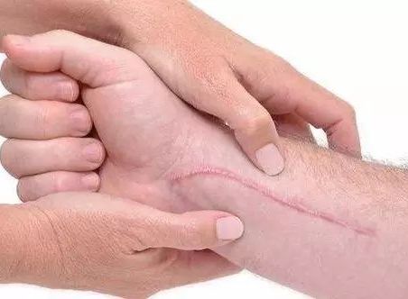 昆明雙眼皮修復，哪家醫(yī)院專業(yè)且可靠？