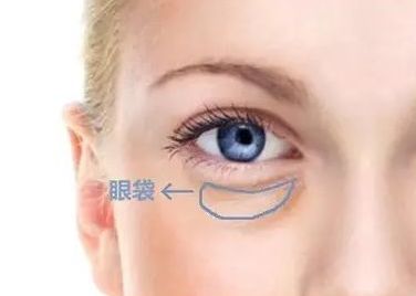 沈陽哪家醫(yī)院治療黃褐斑效果好？