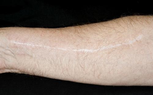 2023樂(lè)山鼻部矯正強(qiáng)榜前10名的醫(yī)生(李凌云、賴運(yùn)泰、岑曉勇實(shí)力強(qiáng))