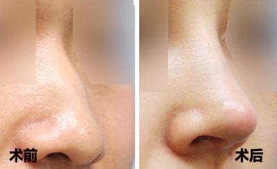 2023銅仁光纖溶脂瘦腿部醫(yī)生排名榜top10強(梁金創(chuàng)、劉真宏、錢炳燊領(lǐng)銜全場！)