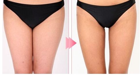 昆明哪家醫(yī)院做拉皮手術(shù)好？體驗分享+專家推薦，盡在本文！