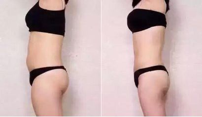 太原哪家醫(yī)院祛痘效果好？專家推薦的太原祛痘醫(yī)院排行榜