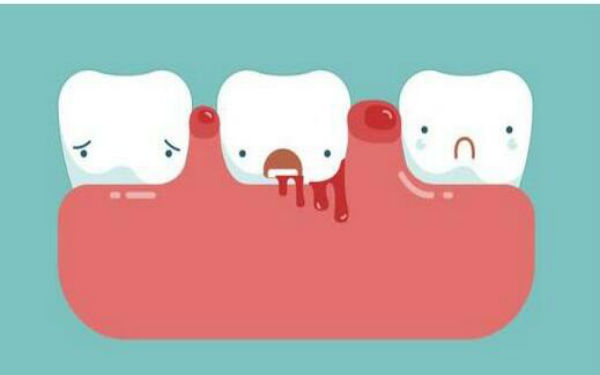 2023西安眉間紋消除權(quán)威專家評價前十位(寇晨程、曹海峰、常玉芳既權(quán)威技術(shù)又先進(jìn))