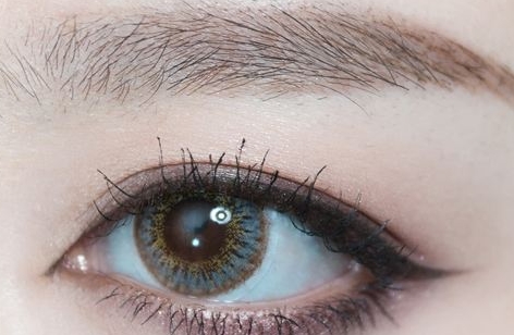 2023四川無(wú)創(chuàng)激光去胎記正規(guī)醫(yī)生口碑前十名(艾玉峰、銀偉男、戴桂華上榜理由一一解析~)