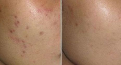 成都星范醫(yī)療美容整形醫(yī)院的醫(yī)生口碑如何？