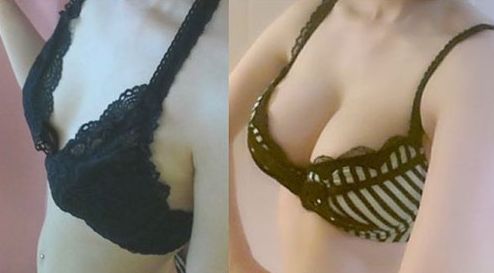 廣州哪家醫(yī)院做微針好？解讀廣州市內(nèi)頂尖微針治療機(jī)構(gòu)