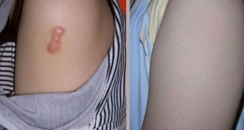 長沙整形哪家美容醫(yī)院好？專家揭秘長沙市頂級整形醫(yī)院排行榜！