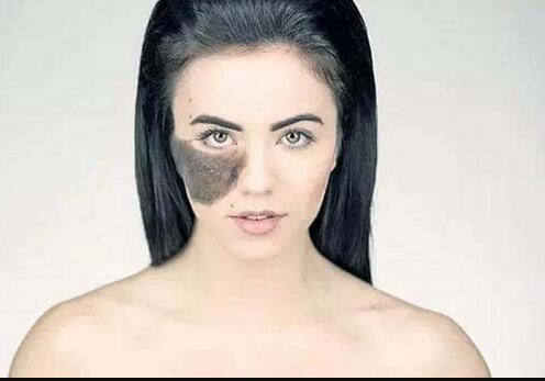 北京比較好的整容醫(yī)院楊欣的吸脂減肥技術(shù)效果如何？