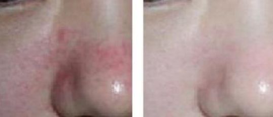 南京整鼻哪家醫(yī)院口碑好？