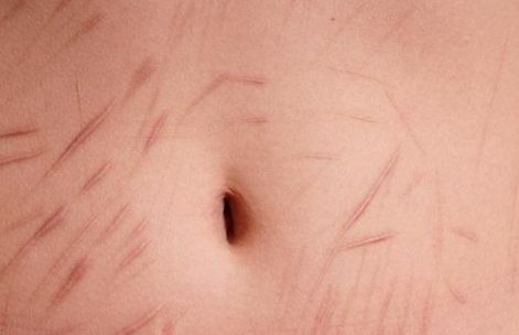 亳州哪家雙眼皮醫(yī)院口碑好，值得信賴？