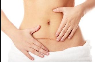 揭秘2023年杭州祛眼袋技術(shù)排行榜：誰(shuí)家的祛眼袋效果最好