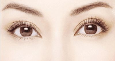 杭州整形哪家好祛眼袋？選擇杭州哪家整形醫(yī)院好祛眼袋效果持久？