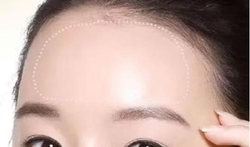 常州治療脫發(fā)哪家醫(yī)院靠譜？