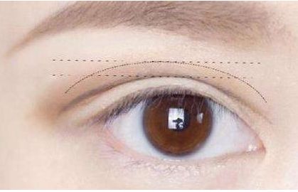 佛山哪家整容醫(yī)院的隆鼻效果出色？