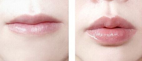 鄭州整形哪家醫(yī)院好？挑選進(jìn)修整形要注意的要點(diǎn)有哪些呢？