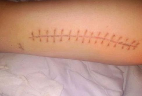 云南哪家鼻子整形效果最好？