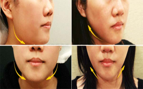 2023石家莊動態(tài)細(xì)紋注射填充權(quán)威醫(yī)生排行榜前10位(馮彥梅、姜福敬、白鵬麗排行榜前十醫(yī)生干貨總結(jié))