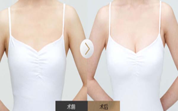 浙江同德醫(yī)院整形醫(yī)生名單、整形案例圖，為大家呈現(xiàn)