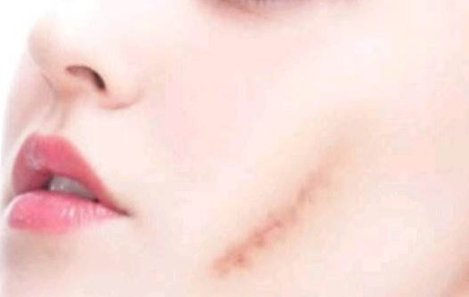 邢臺市下面部拉皮哪家好？匯總一線城市熱門醫(yī)院推薦