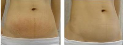 2023浙江專(zhuān)業(yè)無(wú)痕除皺術(shù)上榜清單前10位專(zhuān)家(潘蕾、孫燚、姚偉華口碑與實(shí)力雙重保障！)