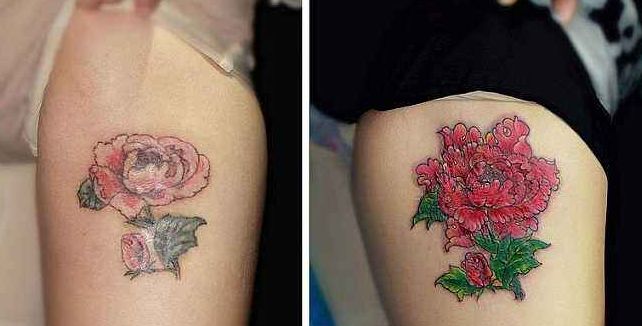 杭州填淚溝哪家醫(yī)院好？專家推薦的最佳醫(yī)療機構