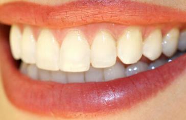 2023蘭州超聲刀去眼皺紋上榜清單前10強(qiáng)醫(yī)生(蘆蔓莉、蘇子平、加曉東優(yōu)點(diǎn)很明顯)