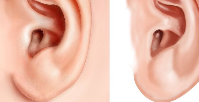 無錫看鼻子哪家醫(yī)院好？綜合評測揭秘無錫市專業(yè)鼻科醫(yī)院推薦