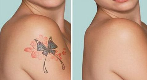 昆明燒傷疤痕消除專家推薦：百家醫(yī)院評(píng)選全指南