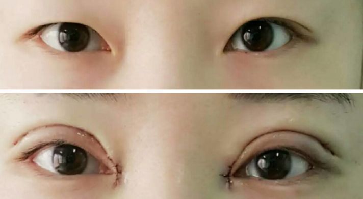 貴陽哪家醫(yī)院熱瑪吉效果好，值得推薦？