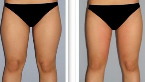 杭州疤痕醫(yī)院排名哪家好？揭秘杭州頂級疤痕醫(yī)院榜單！