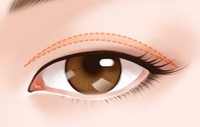 上海激光祛痣哪家醫(yī)院效果最好？