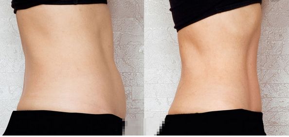 上海祛斑術(shù)哪家醫(yī)院好？解讀上海祛斑術(shù)醫(yī)院排名和專家推薦