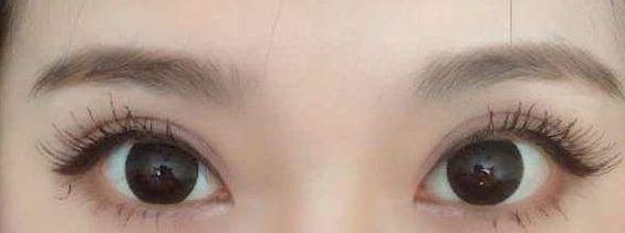 西安哪家醫(yī)院的激光祛痘項目質(zhì)量好？