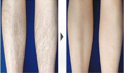 哈爾濱哪家醫(yī)院祛斑好？-排名第一的專業(yè)醫(yī)院，讓您擁有無(wú)瑕疵肌膚！