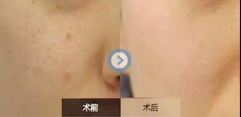 2023葫蘆島干細(xì)胞祛疤印排行TOP10的專家(高建華、朱杰、周栩口碑評(píng)價(jià)好)