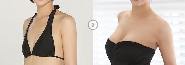 鄭州瘦臉針效果如何？一起探討哪家醫(yī)院好！