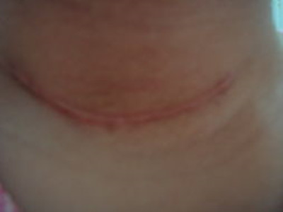 2023南京精雕雙眼皮專家綜合實(shí)力排名(余立冬、王長(zhǎng)會(huì)、周穎華深得老用戶口碑)